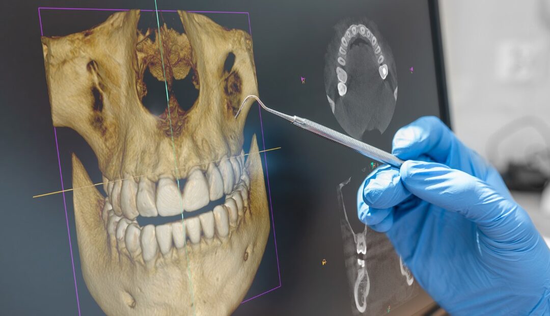 Quanto Custa Uma Tomografia Odontológica?