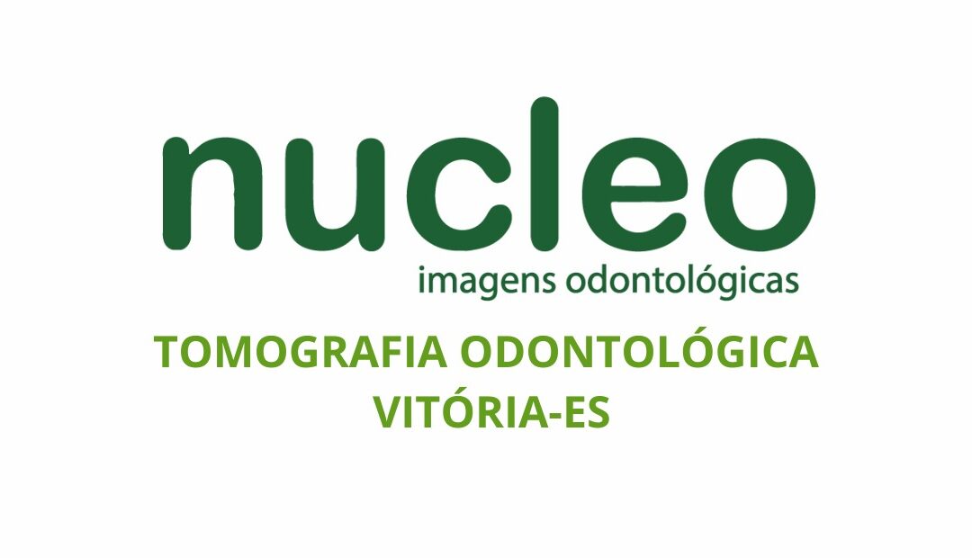 Tomografia Odontológica em Vitória-ES