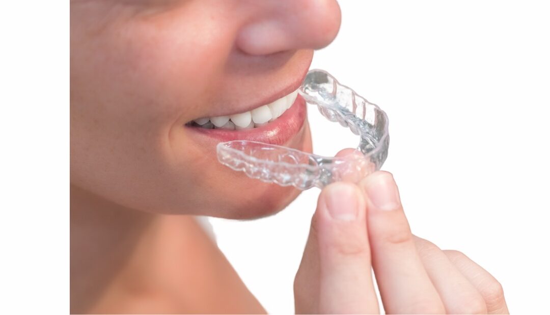 Tomografia Odontológica Cone Beam na Ortodontia